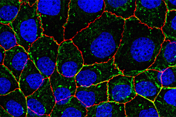 A microscope image of stiffened cells within in the epithelial monolayer