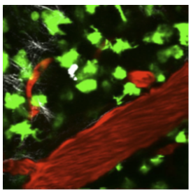 Developing tools to assess macrophage activation